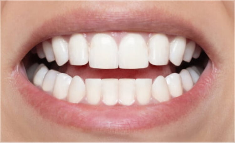 After - Kingswood Dental Practice