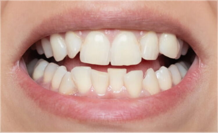 Before - Kingswood Dental Practice